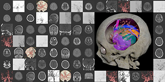 脳神経外科医が 3D CG による可視化で切り開く未来の医療